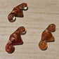 Tiny uterus